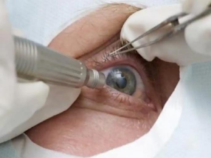 The Global Times | कोरोना काळात मोतिबिंदू बळावला